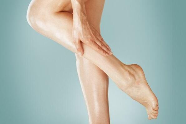 varices